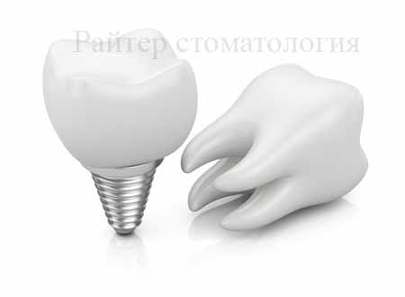 импланты альфа био